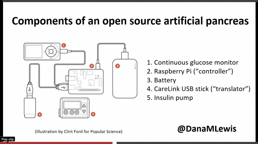 OpenAPS components