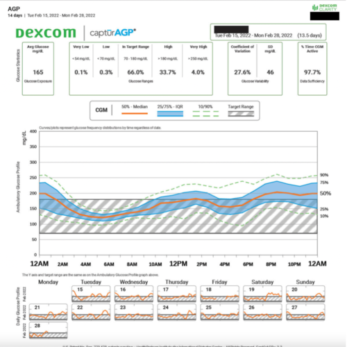 dexcom agp