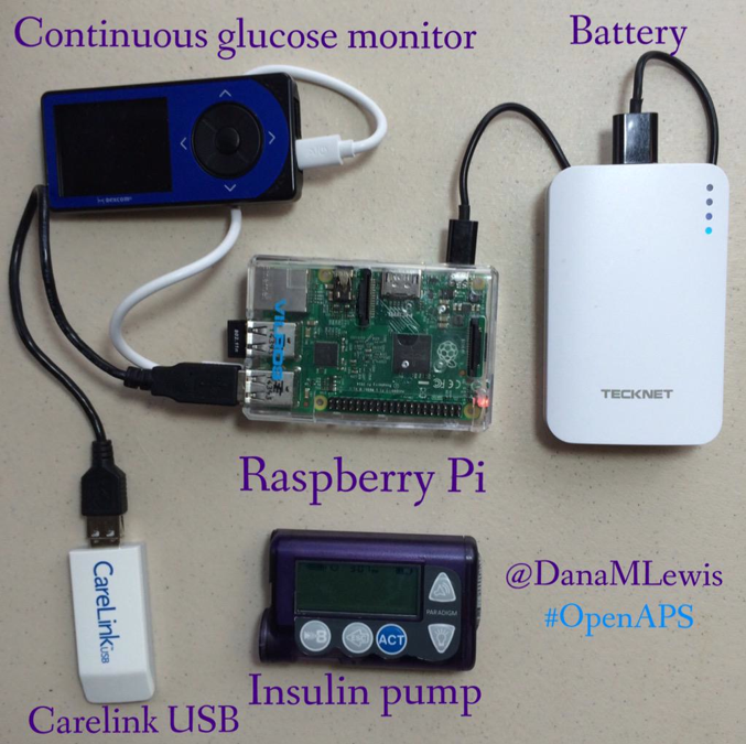 Artifical Pancreas Systems